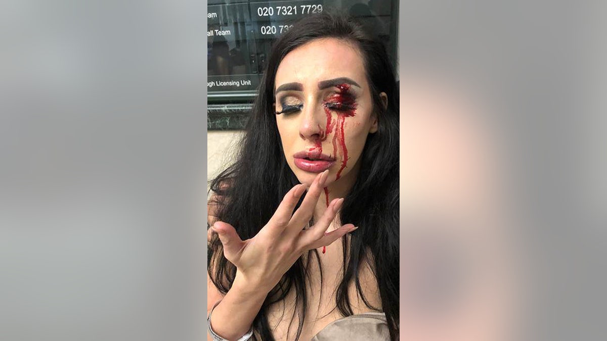 This image shows Stevenson's injuries.