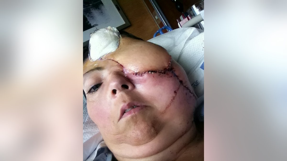 Kristie Young is seen as she appeared in the months after her accident.
