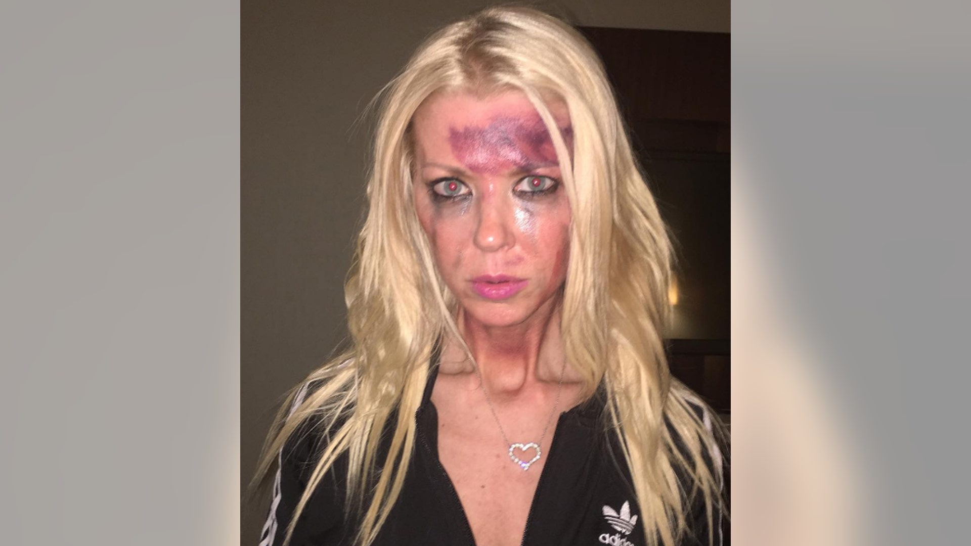 Tara Reid shocked fans when she shared a picture of herself with bruises on her face. Turns out the bruises are really makeup as Reid is starring in a new film "Worthless" about bullying. "Everyone be kind to each other," Reid writes in the caption. "This is what bullying looks like. #Worthless." Click here for more pics of the star on Hollywoodlife.com.