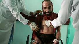 Ex-inmates: Torture rife in prisons run by Yemen rebels