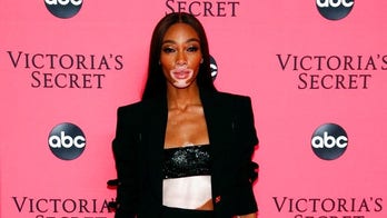 Winnie Harlow defends ‘America’s Next Top Model’ comments