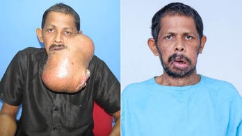 Surgeons remove massive cancerous tumor from man's jaw