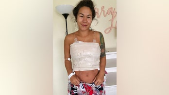 Bikini model claims 'breast implant illness' left her with bald spot, rash