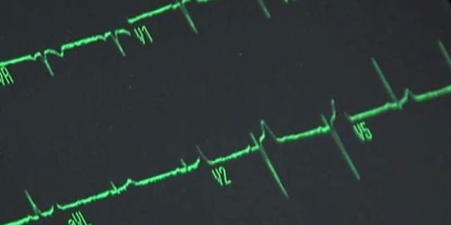 A woman who recently survived a heart attack is sharing her story to help others identify the signs.