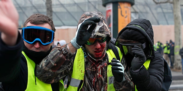 A demonstrator wearing a yellow vest is covered in blood after getting in injured during a protest in Paris, Saturday, Dec. 8, 2018.