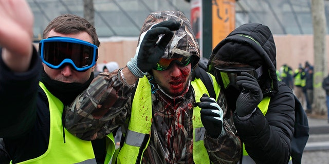 A demonstrator wearing a yellow vest is covered in blood after getting in injured during a protest in Paris, Saturday, Dec. 8, 2018.