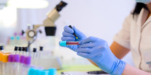 The breakthrough could lead to much earlier detection and more chance of a cure - with treatment beginning even years before symptoms develop.