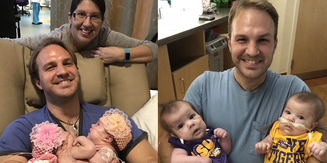 Formerly Conjoined Twins Head Home After 7 Surgeries Fox News