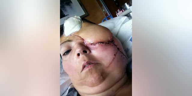 Kristie Young is seen as she appeared in the months after her accident.