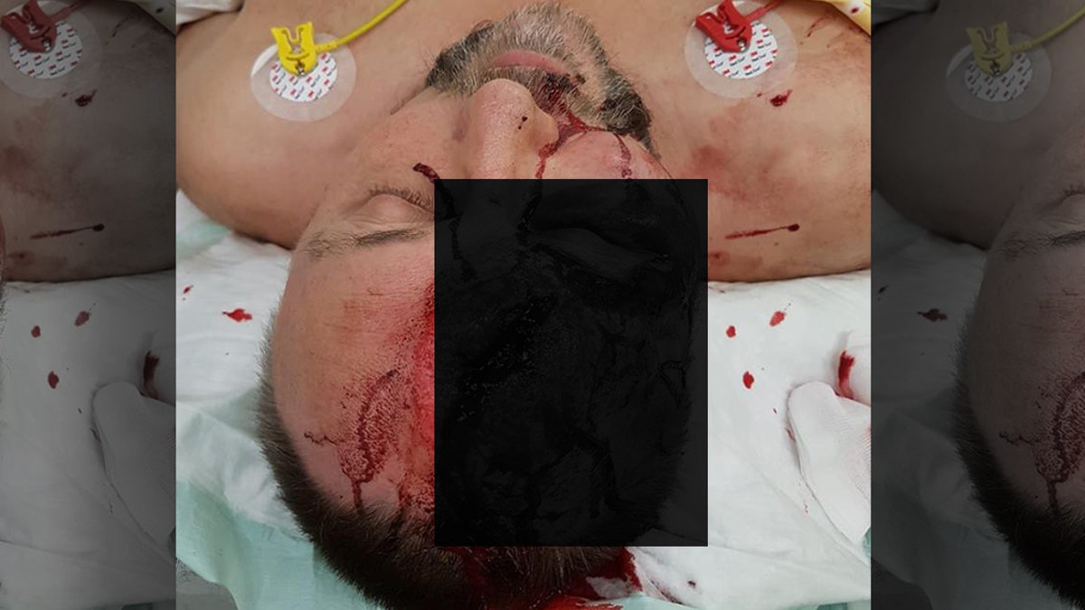 Magnitz was beaten in an "assassination attempt," according to his party.