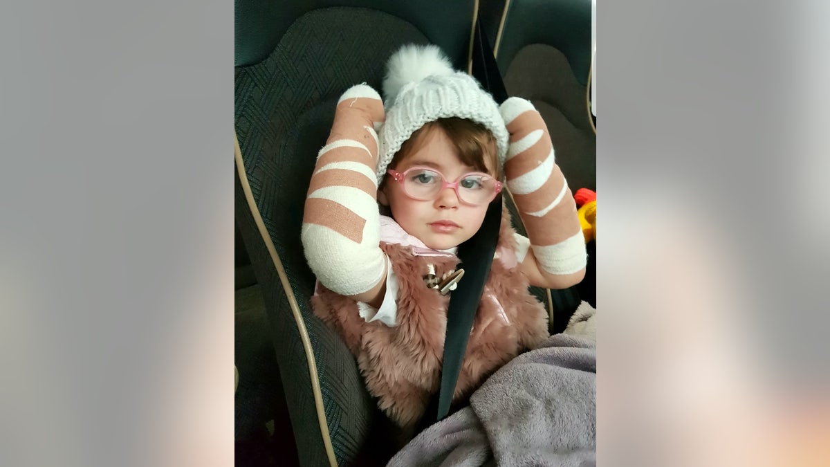 Rosie-Faye Yeadon had to be rushed to the hospital for urgent treatment when her hands and arms caught fire as she tried to rescue her twin sister, Poppy Mai's Minnie Mouse toy.