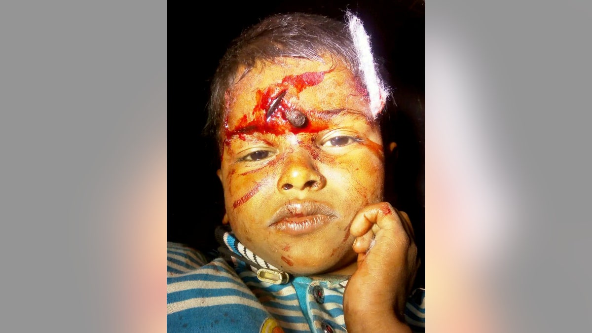 The boy had been playing in a field while repairmen worked on a broken water pump.