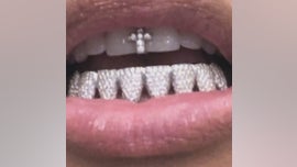 Kim Kardashian West shows off diamond 'grillz' in social media posts ...