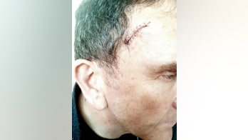 Stylist spots man's cancer while brushing his hair