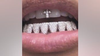 Kim Kardashian West shows off diamond 'grillz' in social media posts