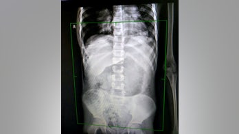 Boy impaled by tree branch walked sister home before collapsing, family says