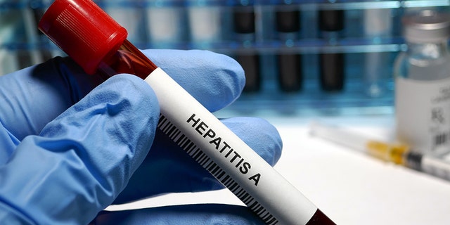 Hepatitis A blood test and treatment