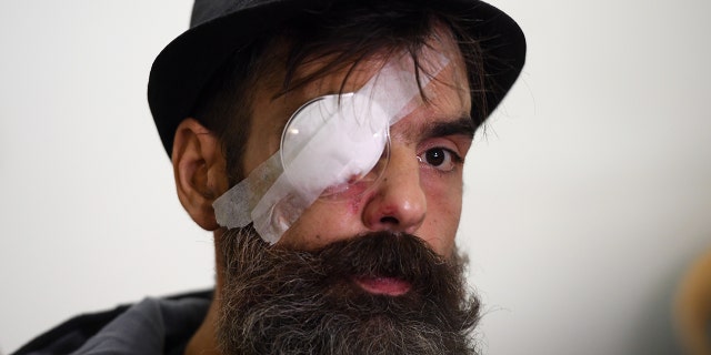 Jerome Rodrigues, one of the leaders of the yellow vest movement, gives a press conference, on January 27, 2019 at the Cochin hospital in Paris, one day after getting wounded in the eye during an anti-government demonstration called by the Yellow Vests "Gilets Jaunes" movement