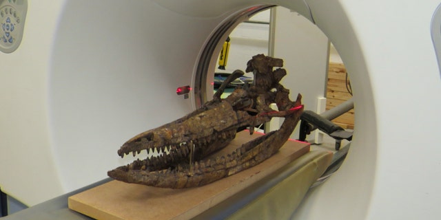 CT scanning of the skull