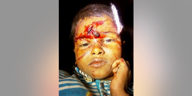 The boy had been playing in a field while repairmen worked on a broken water pump.
