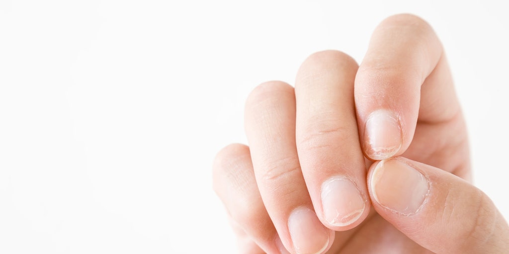 7 nail symptoms and conditions you shouldn't ignore - TODAY