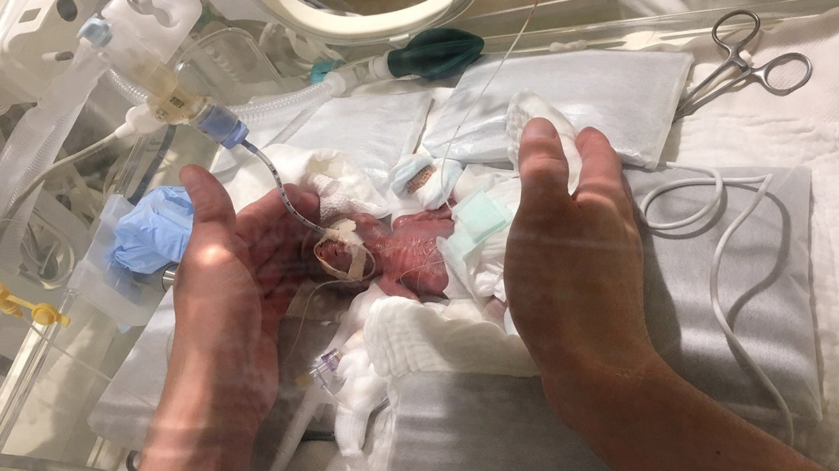 He is believed to be the smallest surviving baby boy in the world, surpassing a Germany baby who was born weighing 9.6 ounces in 2009.