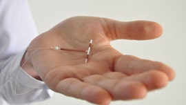 X-ray of mom's abdomen reveals IUD that 'fell out' a decade earlier: report