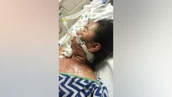 LA teen left with painful blisters, burns in severe reaction to medication