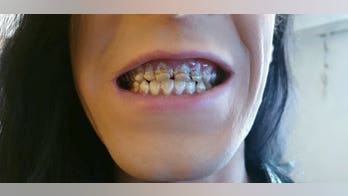 Man claims energy drink addiction rotted his teeth, caused severe pain