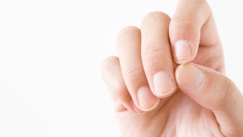 How this mark on your nail may reveal skin cancer