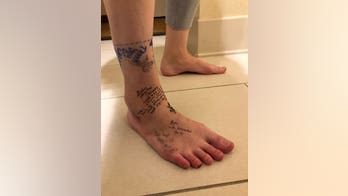Colorado woman pens 'breakup' note on foot before amputation