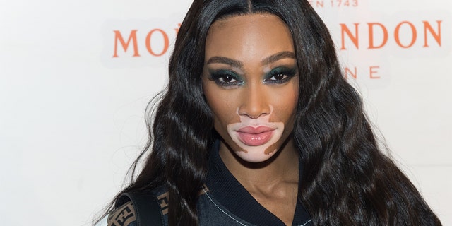 “I’m so excited for people to see vitiligo be put under such a beautiful, sexy light and prove that our bodies can be celebrated,” the 24-year-old trailblazer said. “And this goes for all body types and conditions. We’re redefining the swimsuit body.”