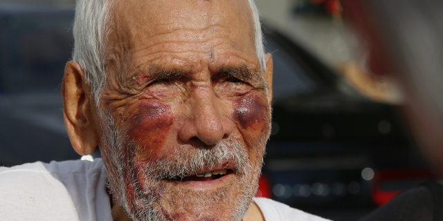 FILE - In this July 11, 2018, file photo, Rodolfo Rodriguez, 92, thanks well-wishers for their help, as he talks to the media gathered outside his home in Los Angeles. A Los Angeles woman has been sentenced to 15 years in prison in the beating of the 92-year-old man that was captured on video and shared widely on social media. Thirty-year-old Laquisha Jones was sentenced Thursday, Feb. 28, 2019, following her no contest plea to elder abuse in December. Prosecutors say Jones severely beat Rodriguez in the face with a brick on July 4 as the elderly man was taking a walk. (AP Photo/Damian Dovarganes, File)