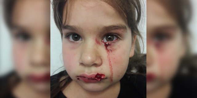 Gabriella Gonzalez sustained serious facial injuries from the attack.