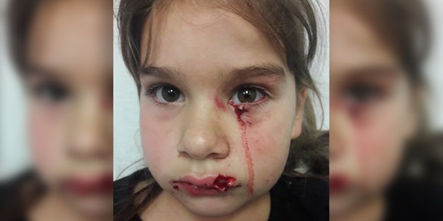 Gabriella Gonzalez was seriously injured in the face during the attack.