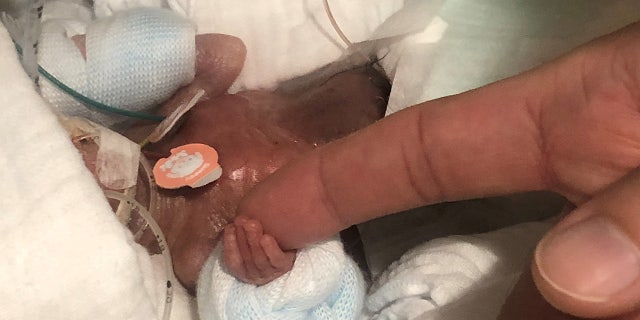 The boy's mother, who was not identified, said she is "happy he has grown this big" because she wasn't sure if he could survive.