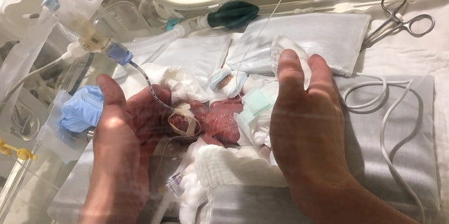 He is believed to be the smallest surviving baby boy in the world, surpassing a Germany baby who was born weighing 9.6 ounces in 2009.