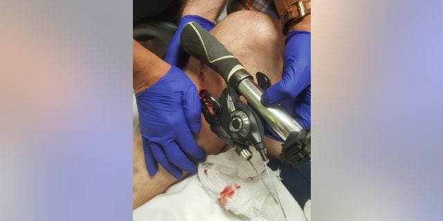 When the bike landed the handlebars skewered his right leg leaving him agonizing pain.