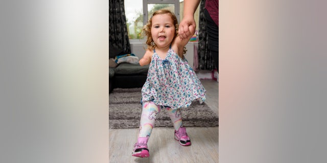 Harmonie-Rose first learned to walk unaided on her prosthetics about two years after receiving them.