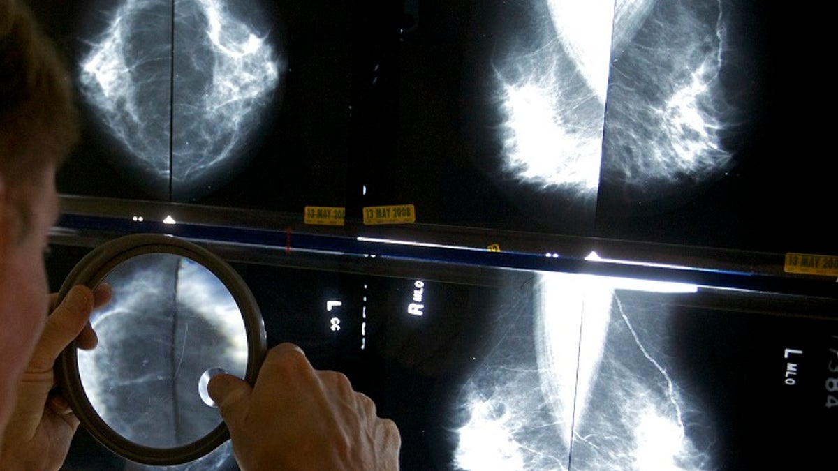 A radiologist uses a magnifying glass to check mammograms for breast cancer. (AP)