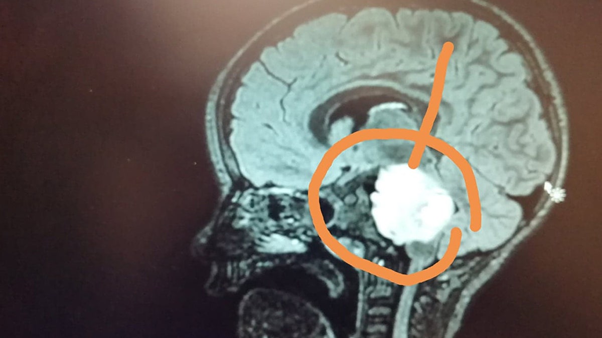 Doctors discovered an aggressive brain tumor and informed Jack's parents that he likely has between six months and one year to live.
