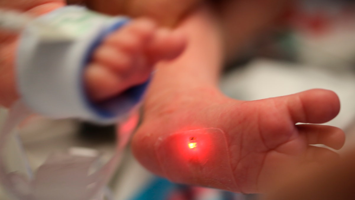 This 2019 photo provided by Northwestern University shows a soft, flexible wireless sensor applied on a foot of a family's baby, who is involved in the clinical trial at Ann & Robert H. Lurie Children's Hospital of Chicago.