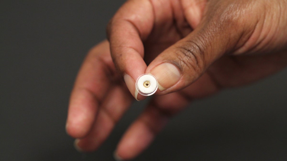 The white ring is the contraceptive patch.