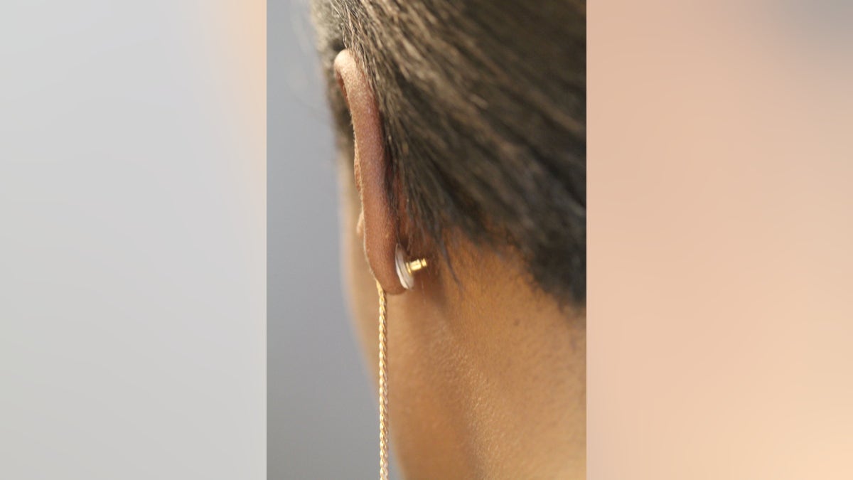 An example of the contraceptive earring being worn.
