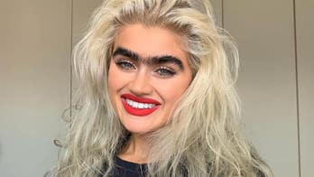 Model with prominent eyebrows aims to change beauty standards by refusing to conform