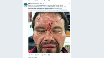 Polish journalist in Venezuela tormented, viciously beaten by government 'death squad,' his employer says