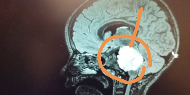 Doctors discovered an aggressive brain tumor and informed Jack's parents that he likely has between six months and one year to live.