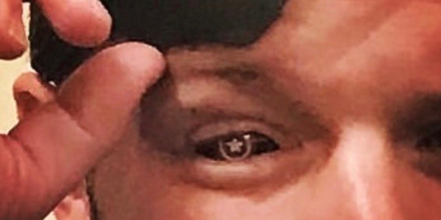 The Texas congressman tweeted snaps of him lifting his eyepatch to show his glass eye that had the “Captain America” star shield.