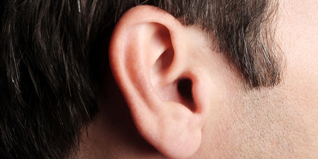 “Unfortunately, that is ear-reversable.”