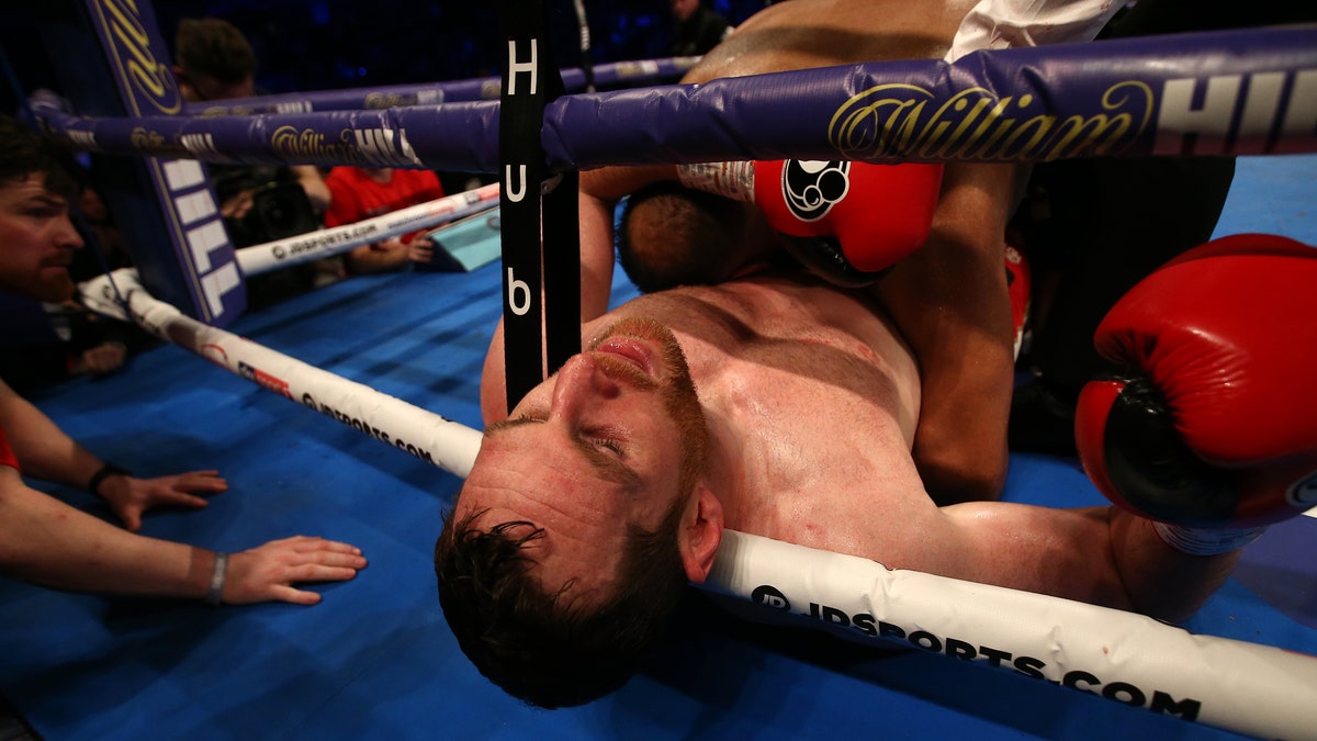 David Price reacts after being bitten by in Kash Ali during their heavyweight bout at M&amp;S Bank Arena on March 30, 2019 in Liverpool, England.